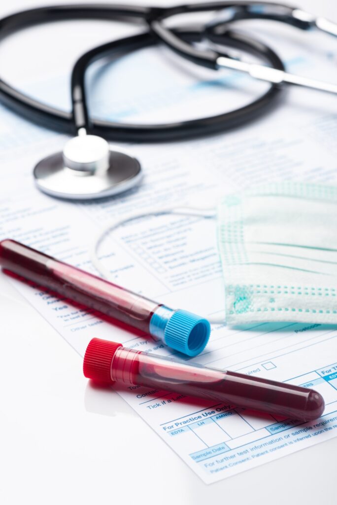 Laboratory Testing Patient’s Blood Samples for Presence of Coronavirus (COVID-19). Test Tube